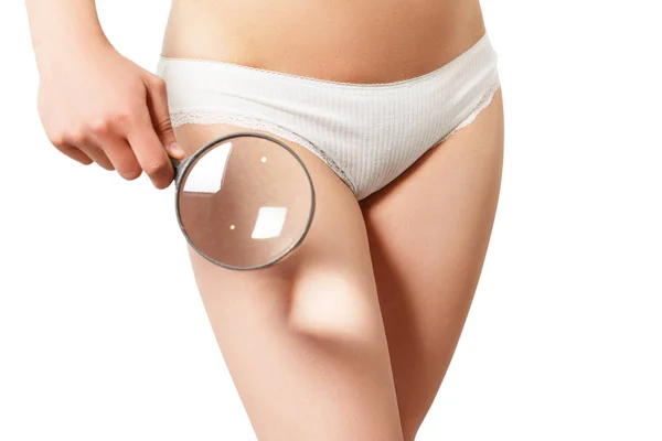 Donna che controlla la cellulite con lente d'ingrandimento, isolata sullo sfondo — Foto Stock