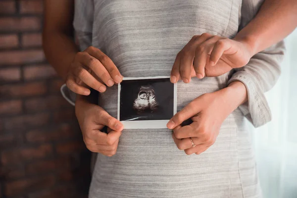 Casal imagem ultra-som na barriga gravidez — Fotografia de Stock