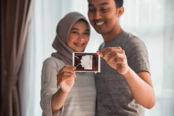 Ellerde ultrason görüntüleri ile Müslüman çift — Stok fotoğraf