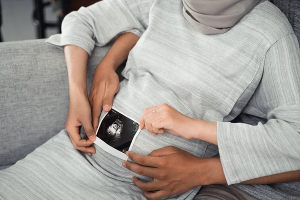 Couples hand hold at ultrasound on pregnant belly — Stock Photo, Image