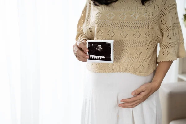 Mujer embarazada asiática sosteniendo ultrasonido exploración al estar de pie — Foto de Stock