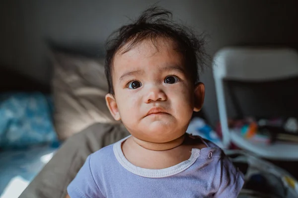 Rashes on asian baby — Stock Photo, Image