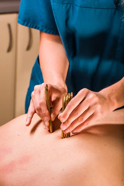 Tæt Visning Massage Terapeut Gør Dybt Væv Krop Massage Terapi - Stock-foto