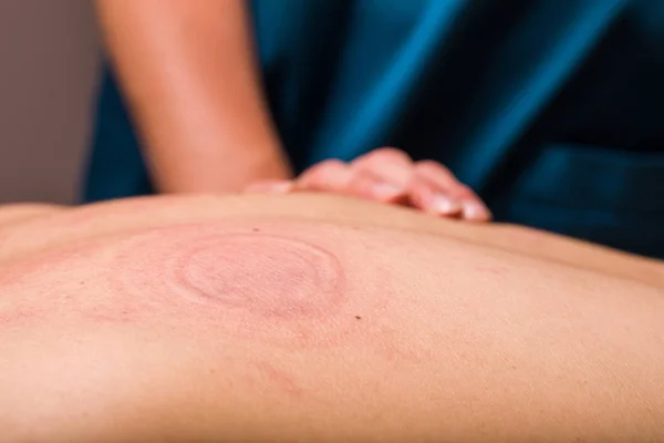 Vista Vicino Del Massaggiatore Che Una Terapia Massaggio Del Corpo — Foto Stock