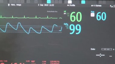 Ameliyat sırasında Ekg kalp monitörü.