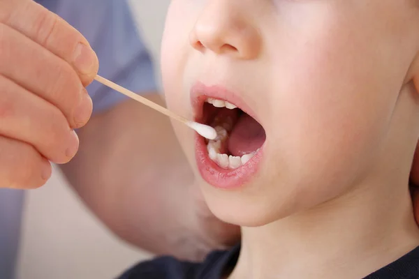 doctor takes a cotton bud from childs mouth to analyze the saliva, mucous membrane for DNA tests, COVID-19, to determine paternity or presence of virus, concept