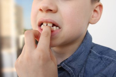 Çocuk elini ısırır ve ısırır. Yakın plan, psikolojik bozukluk, stres, kötü çocukluk alışkanlıkları.