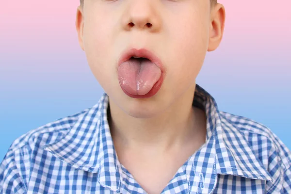 boy, kid performs articulation exercises for the development of the speech apparatus, close-up tongue, concept of speech disorders, methods for their correction, methods exercises