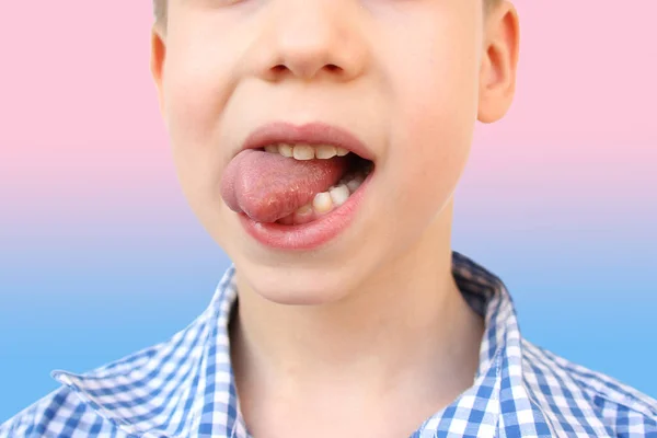 boy, kid performs articulation exercises for mouth, concept of speech disorders, correction, frenum of tongue, methods of correctional developmental exercises