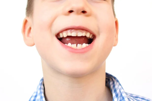 Menino Criança Sorrindo Com Boca Aberta Close Crianças Boca Dentes — Fotografia de Stock