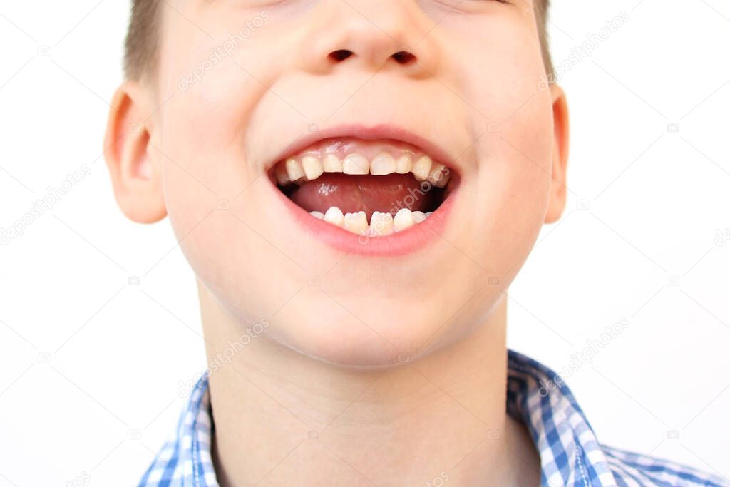 boy, kid smiling with open mouth, close up of childs mouth, teeth, concept of child skin care, emotional development of elementary school students, dentistry 