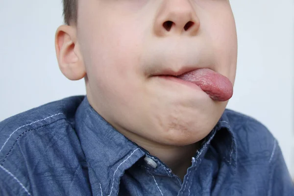 boy, kid performs articulation exercises for the development of the speech apparatus, close-up language, the concept of speech disorders, methods for their correction, methods of correctional developmental exercises