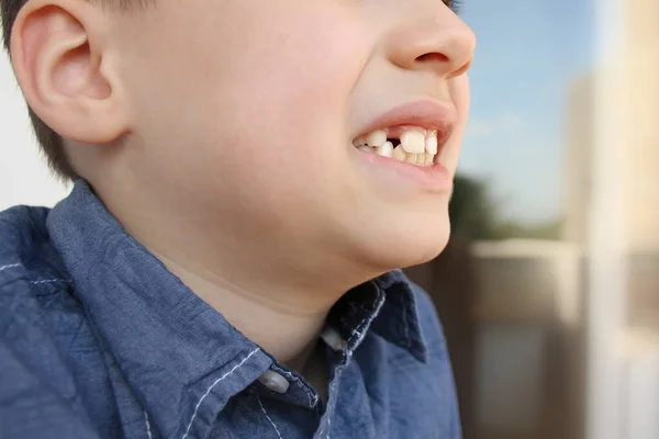 Kind Toont Met Zijn Vinger Een Melktand Die Zwaait Pijn — Stockfoto