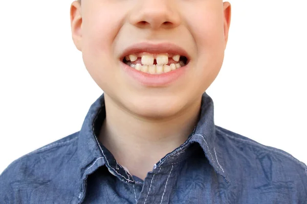 Boca Abierta Niño Con Dientes Primer Plano Boca Del Bebé —  Fotos de Stock