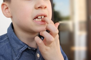 Çocuk elini ısırır ve ısırır. Yakın plan, psikolojik bozukluk, stres, kötü çocukluk alışkanlıkları.