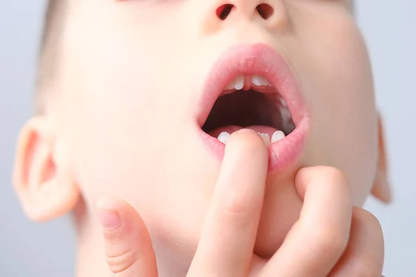 Jongen Kind Houdt Zijn Vinger Zijn Mond Toont Nieuwe Kiezen — Stockfoto