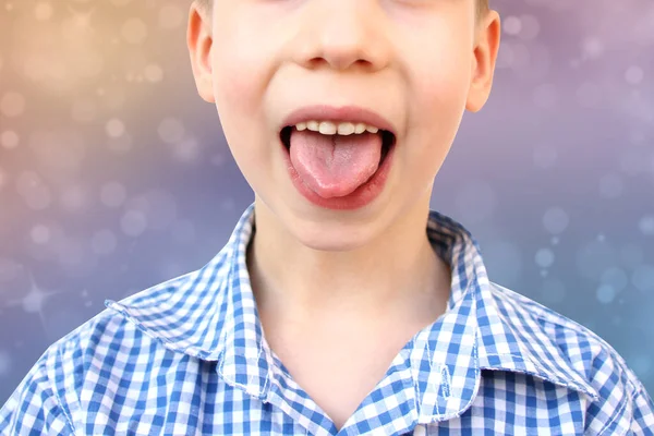 Oğlum Çocuk Ağzını Açtı Ağız Boşluğu Yakın Çekim Dişleri Dil — Stok fotoğraf