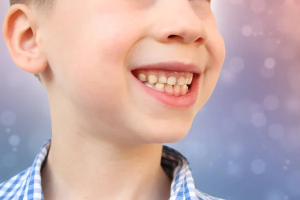 Αγόρι Παιδί Χαμογελά Ανοιχτό Στόμα Κοντινό Πλάνο Του Στόματος Των — Φωτογραφία Αρχείου