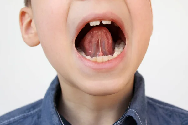 Chłopiec Dzieciak Otworzył Usta Jamy Ustnej Zbliżenie Zębów Wykonuje Ćwiczenia — Zdjęcie stockowe