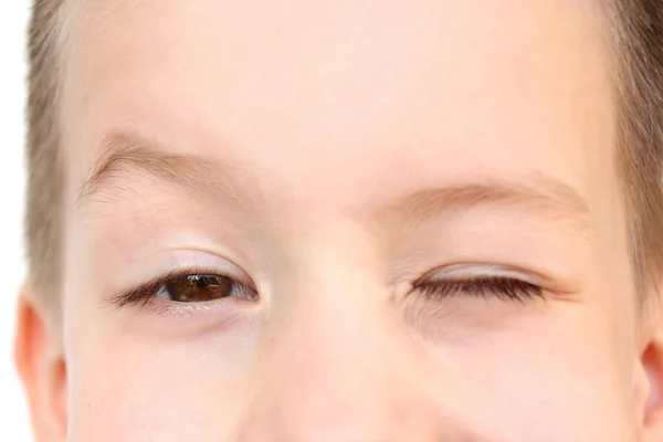 Αγόρι Παιδί Squinted Κλείνει Μάτι Μέρος Του Προσώπου Κοντινό Πλάνο — Φωτογραφία Αρχείου