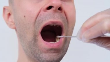 Laboratuvar asistanı ağzından tükürük örneği alıp DNA analizi, yakın çekim ağzı, polis soruşturması konsepti, tıbbi muayene, babalık...