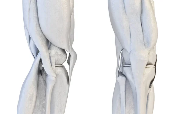 Menselijke kniegewricht instellen. 3D illustratie — Stockfoto