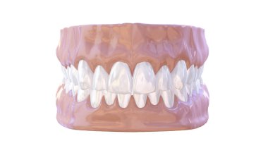 Beyaz arka plan üzerinde diş ve diş eti anatomi modeli tıbbi illüstrasyon izole insan çene. 3D çizim