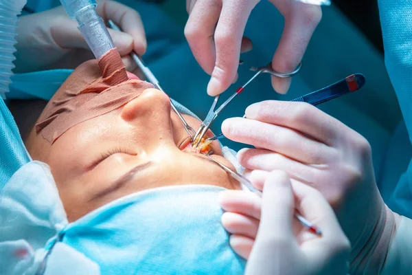 Chirurgia plastica blefaroplastica — Foto Stock