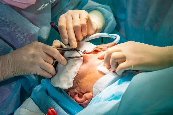 Plastikkirurgi i operationssalen — Stockfoto