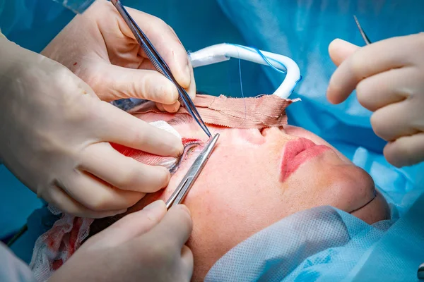 Cirurgia plástica na sala de cirurgia — Fotografia de Stock