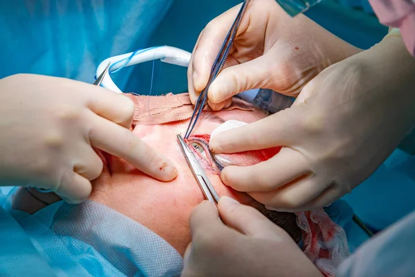 Plastická chirurgie v operačním sále — Stock fotografie