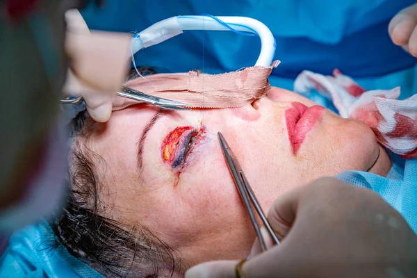 Plastic surgery in operating room
