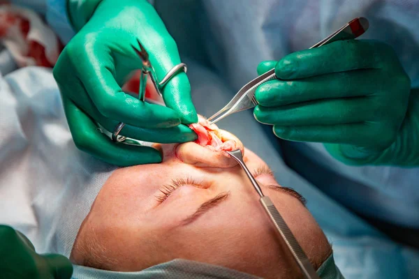 Chirurg und sein Assistent bei Schönheitsoperationen an der Nase im Operationssaal des Krankenhauses. Nasenumformung, Augmentation. Nasenkorrektur. — Stockfoto