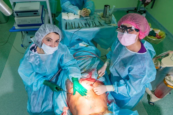 Kosmetycznych liposukcji w rzeczywistej sali operacyjnej, Grupa chirurgów pracujących z kaniuli — Zdjęcie stockowe