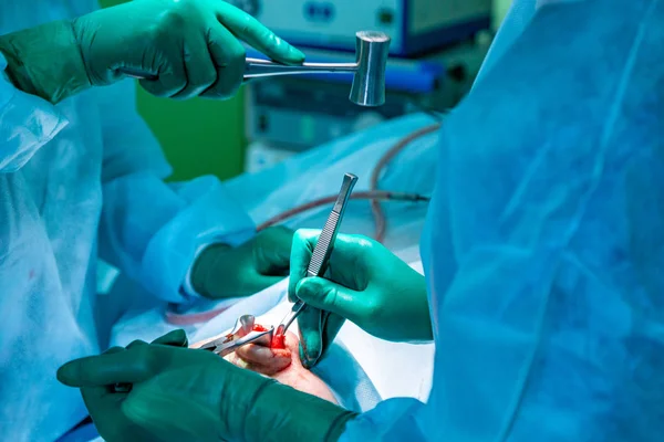 Cirujano y su asistente realizando cirugía estética en la nariz en el quirófano del hospital. Remodelación de la nariz, aumento. Rinoplastia . —  Fotos de Stock