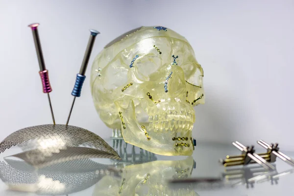 Narzędzia i sprzęt dla ortopedii i chirurgii rekonstrukcja czaszki — Zdjęcie stockowe