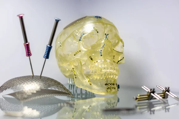 Tools and equipment for orthopedic and surgical reconstruction of the skull — Stock Photo, Image