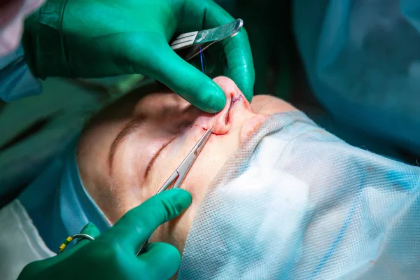 Cirurgião e seu assistente realizando cirurgia estética no nariz na sala de cirurgia do hospital. Reformulação do nariz, aumento. Rinoplastia . — Fotografia de Stock