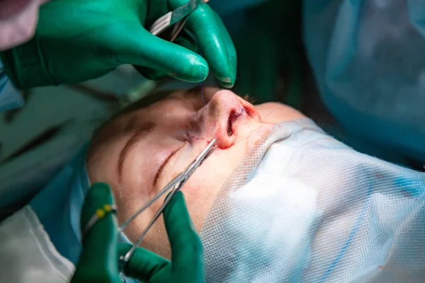 Cirurgião e seu assistente realizando cirurgia estética no nariz na sala de cirurgia do hospital. Reformulação do nariz, aumento. Rinoplastia . — Fotografia de Stock