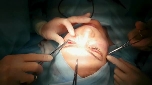 Le chirurgien est en train d'opérer les yeux, gros plan. Correction de. Le docteur fait de la blépharoplastie. Opération en salle d'opération . — Video