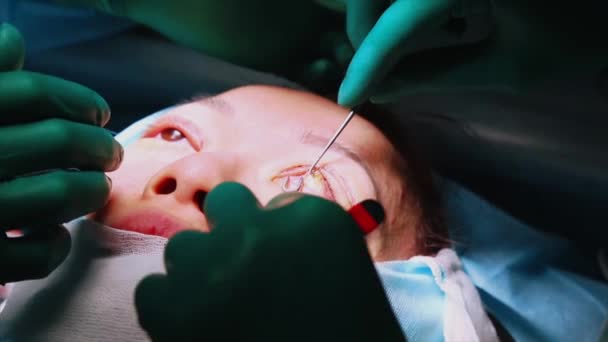 눈에 대 한 작업을 수행 하는 외과 의사 클로즈업. 정정입니다. 의사는 안 검 성형을 한다. 수술 실에서 작업. — 비디오