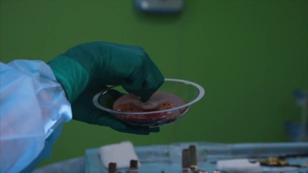 Хирург готовит силиконовый имплантат для операции — стоковое видео