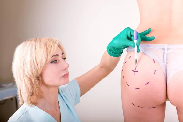 Chirurg kreslení značek na ženské tělo před plastové operace, bílé pozadí. Kosmetička dotknout a nakreslete řádky opravy na Zenske hýždě. Pojem liposukce. Celulitida, vystřihnout. — Stock fotografie