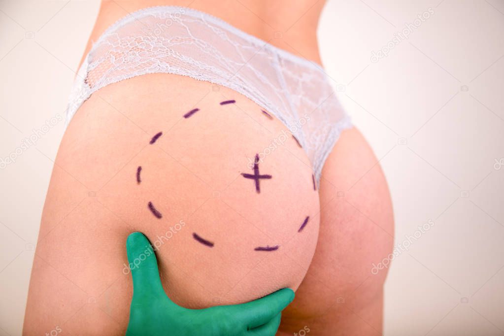 Surgeon drawing marks on female body before plastic operation, white background. Beautician touch and draw correction lines on womans buttocks. Liposuction concept