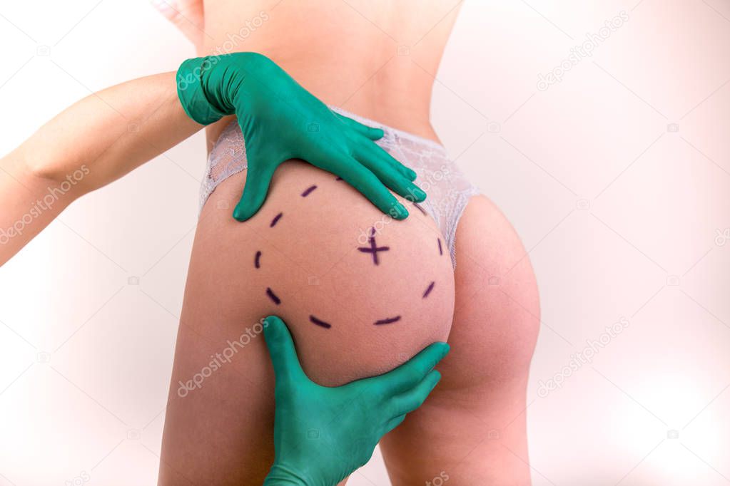 Surgeon drawing marks on female body before plastic operation, white background. Beautician touch and draw correction lines on womans buttocks.