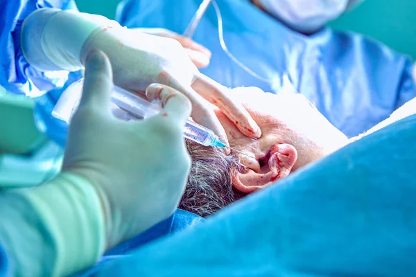 Chin minskning augmentation dubbelhaka borttagning plastikkirurgi kosmetisk operation koncept. Hakan kirurgi närbild med öppna sår. — Stockfoto