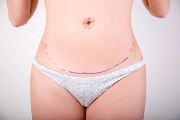 Surgeon drawing marks on female body before plastic operation, white background. Beautician touch and draw correction lines on womans buttocks.