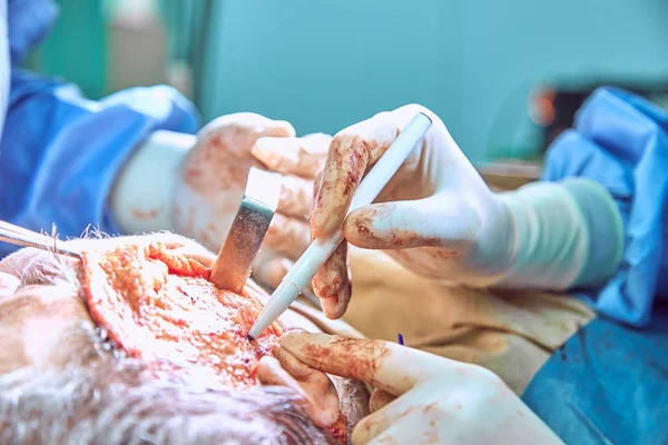 Arc plasztikai sebészet működését. face lift műtét. — Stock Fotó
