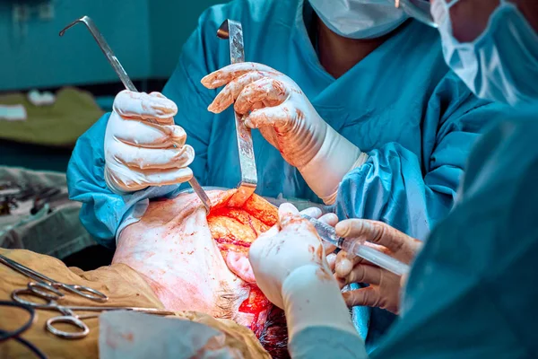 Yüz plastik cerrahi işlem. Yüz dikleştirme ameliyatı. Cerrah cilt hastaları yüzünden ayrılmış. — Stok fotoğraf