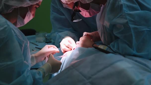Kirurgen utför en operation på ögonen, närbild. Korrigering av. Läkaren gör ögonlocksplastik. Drift i operationssalen. — Stockvideo